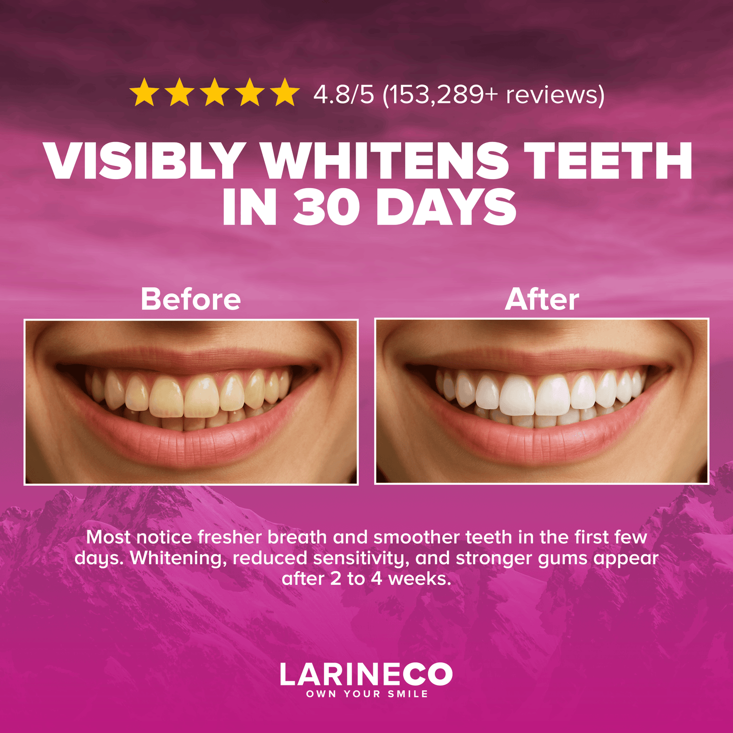 Teeth whitening before and after results.