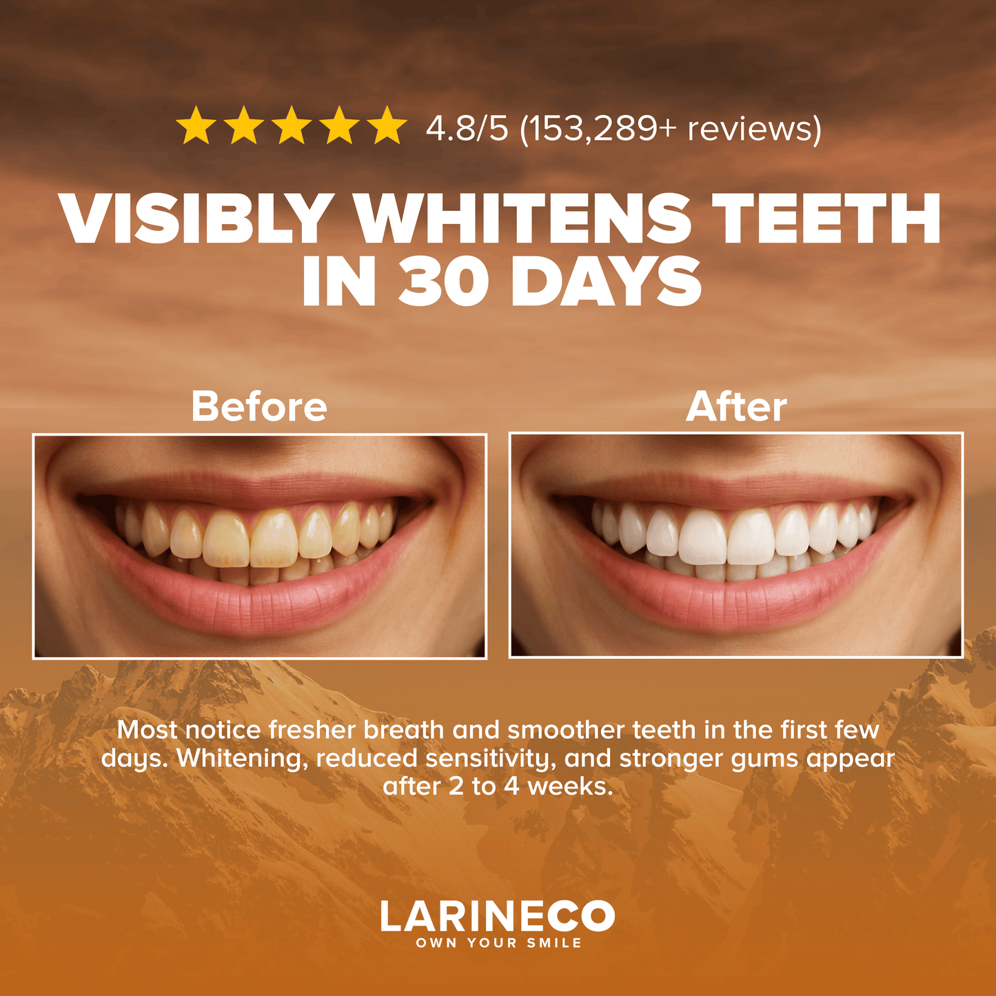 Visibly Whitens Teeth in 30 Days - Before & After