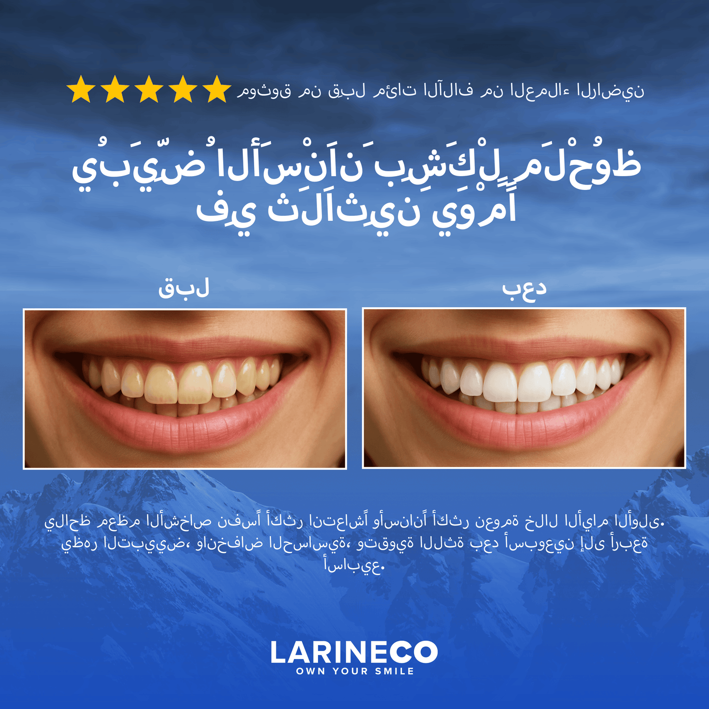 Before/After smile whitening comparison