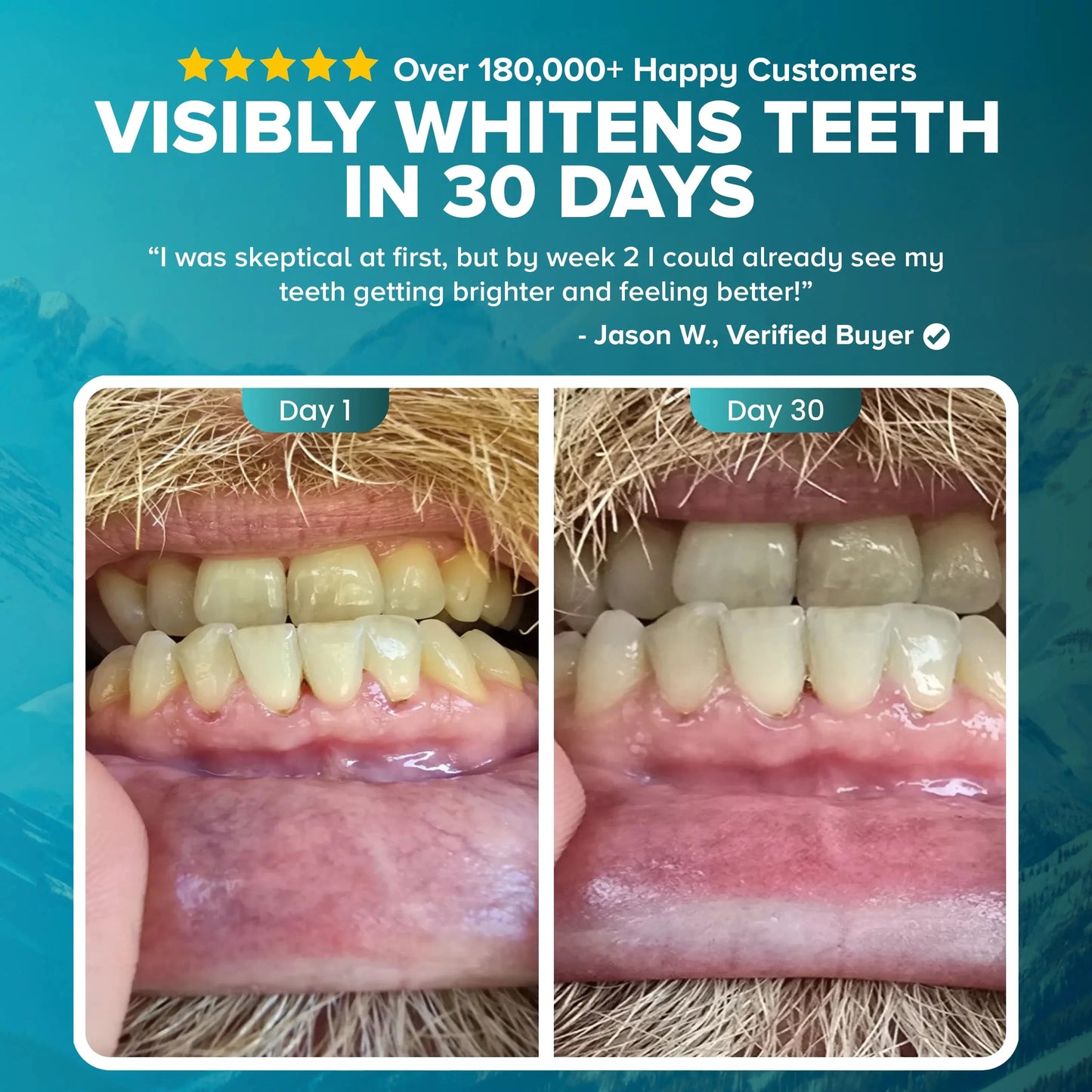 Visibly whiter teeth in 30 days.