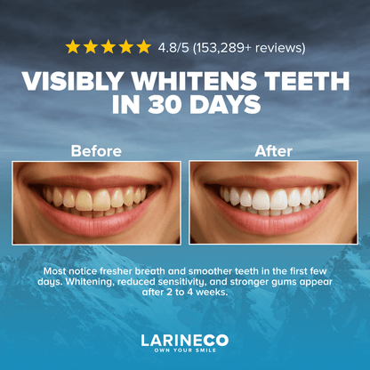 Whitening strips before and after results in 30 days - 4.8/5 rating