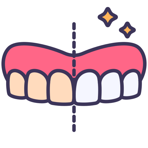 Tooth whitening before and after